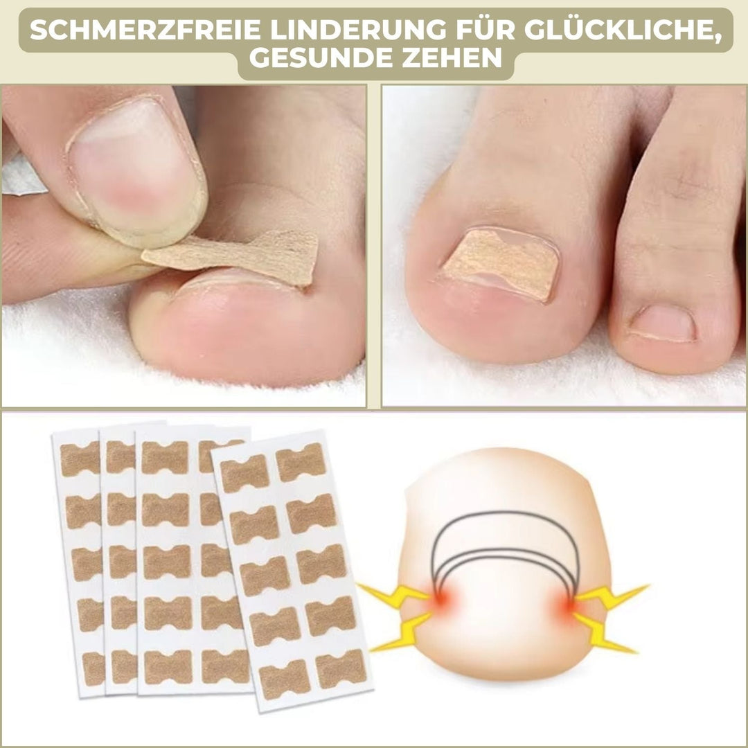 Carvallo | FixaNail - Omedelbar Nagelreparation