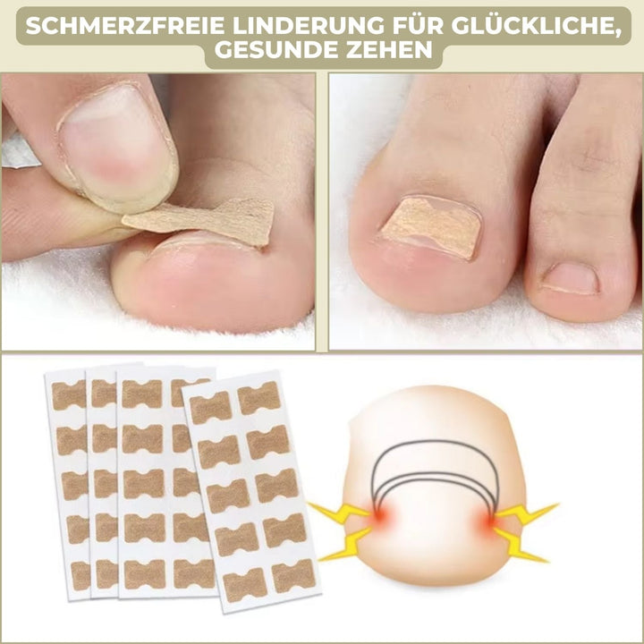 Carvallo | FixaNail - Omedelbar Nagelreparation