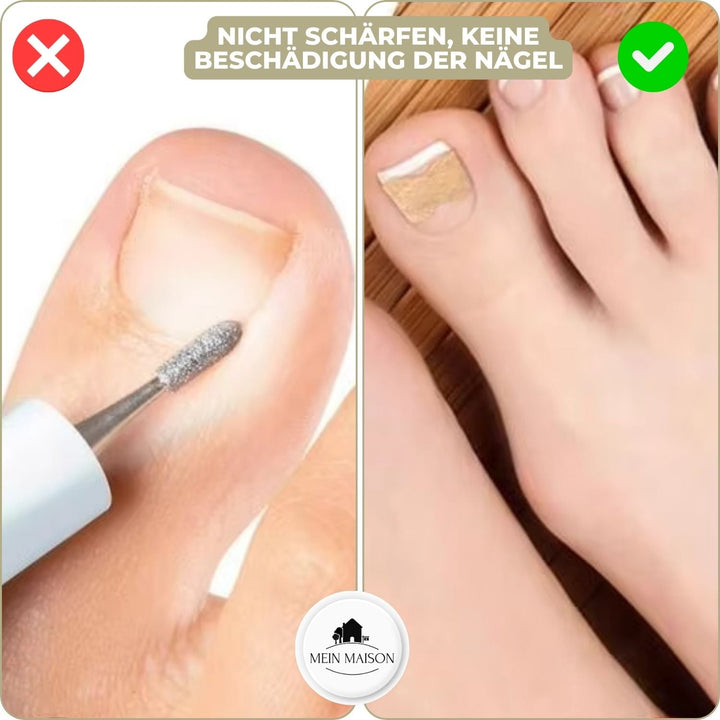 Carvallo | FixaNail - Omedelbar Nagelreparation