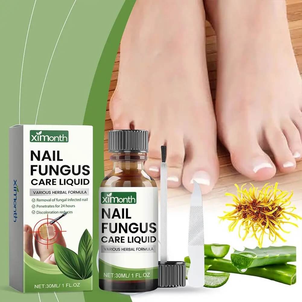 OnyFix – Nagelsvamp Behandling &amp; Återställning av Nagelhälsa