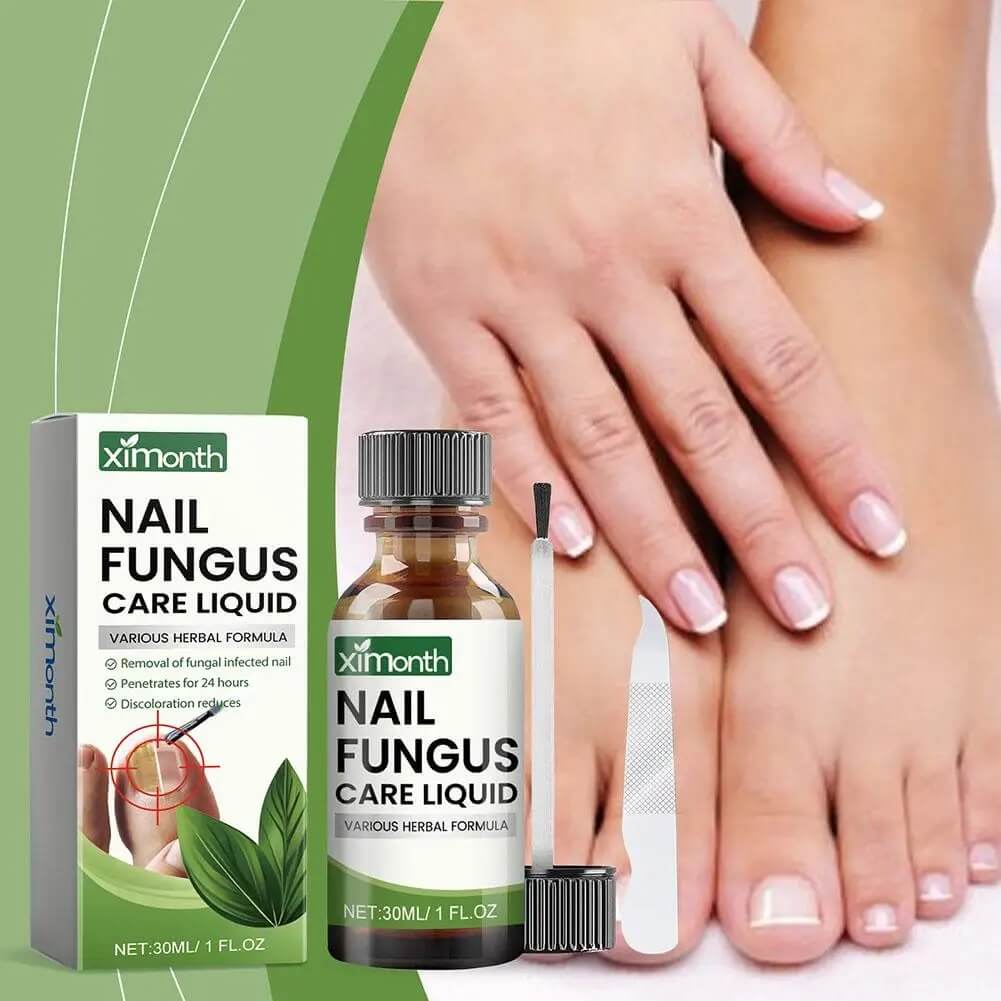 OnyFix – Nagelsvamp Behandling &amp; Återställning av Nagelhälsa