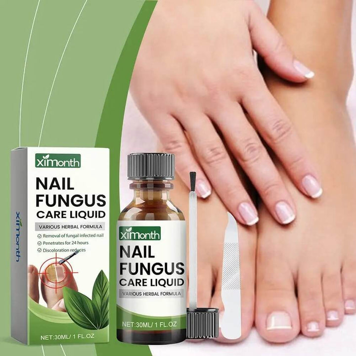 OnyFix – Nagelsvamp Behandling &amp; Återställning av Nagelhälsa