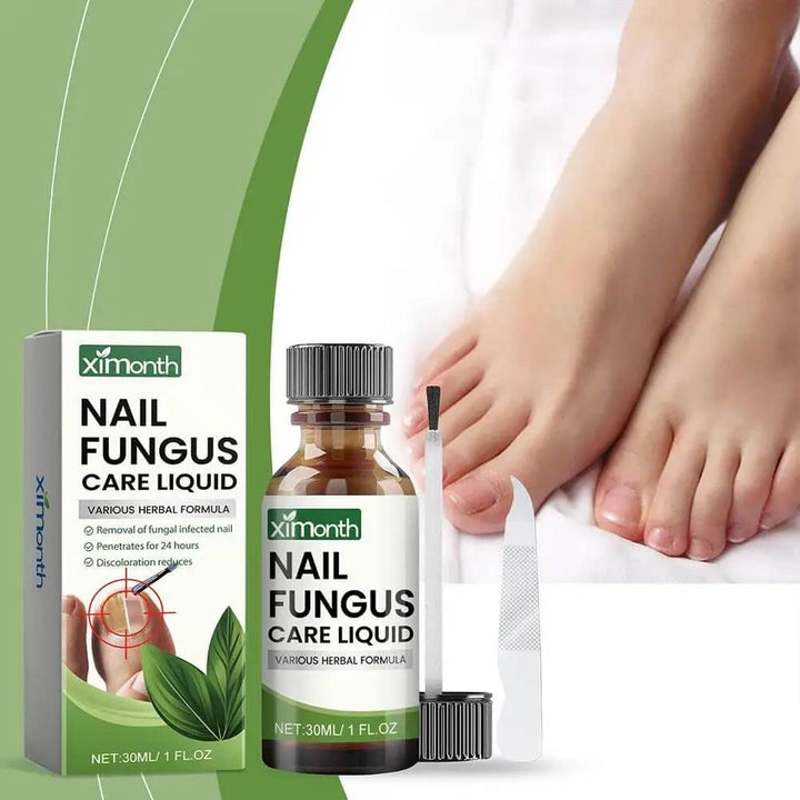 OnyFix – Nagelsvamp Behandling &amp; Återställning av Nagelhälsa