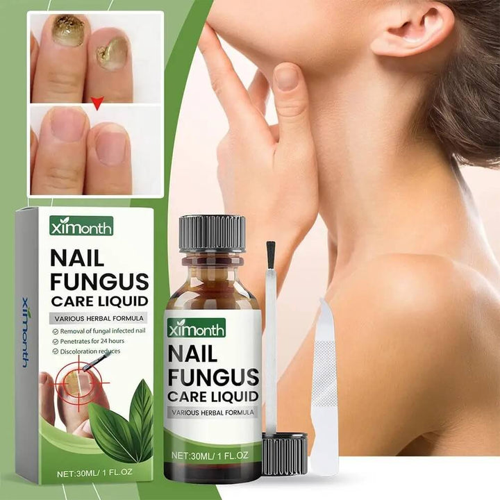 OnyFix – Nagelsvamp Behandling &amp; Återställning av Nagelhälsa